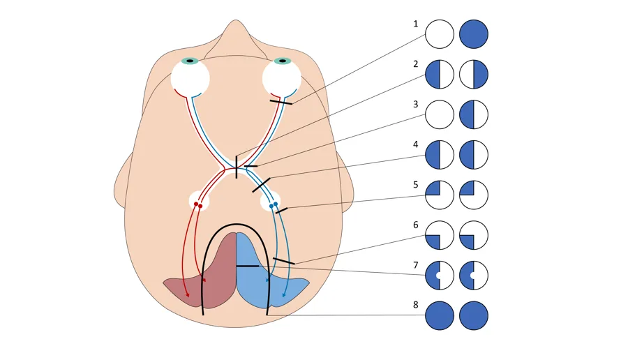 Diagram, skjematisk