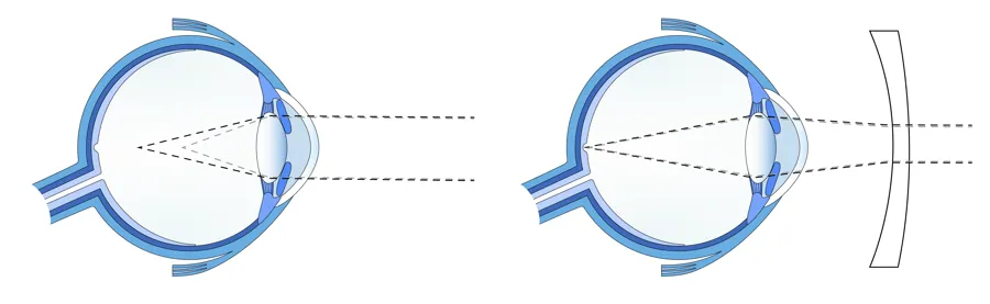 Sunburst-diagram